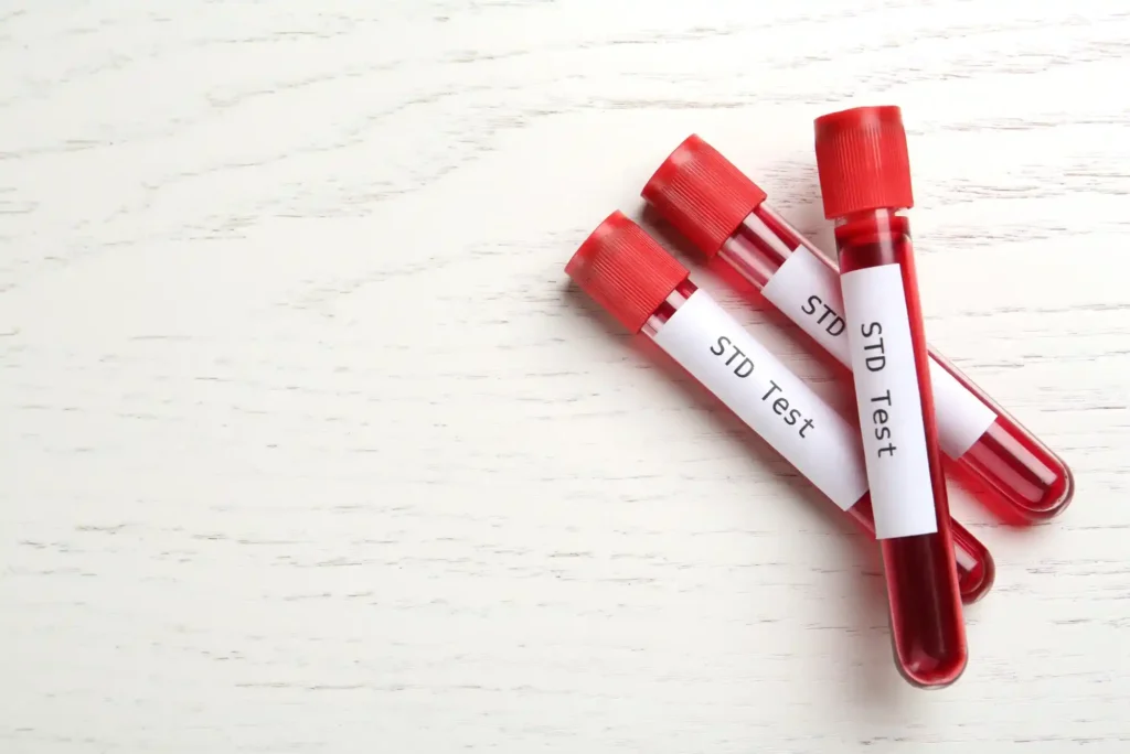 STD-Testing Services at Home in Dubai