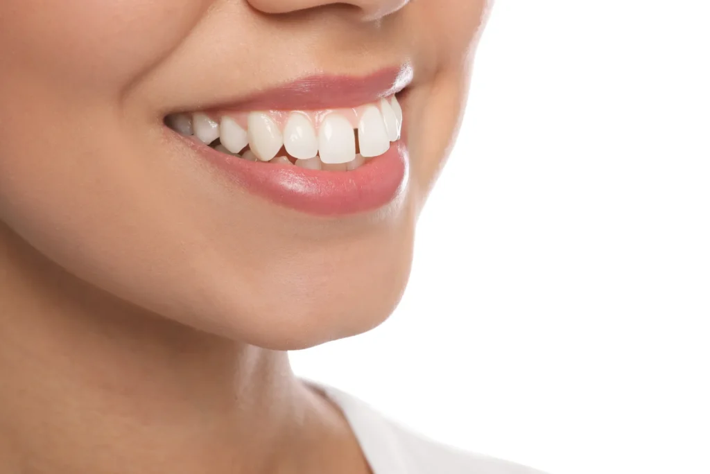 Best All-On-4 Implants in Dubai - Eat & Smile Confidently