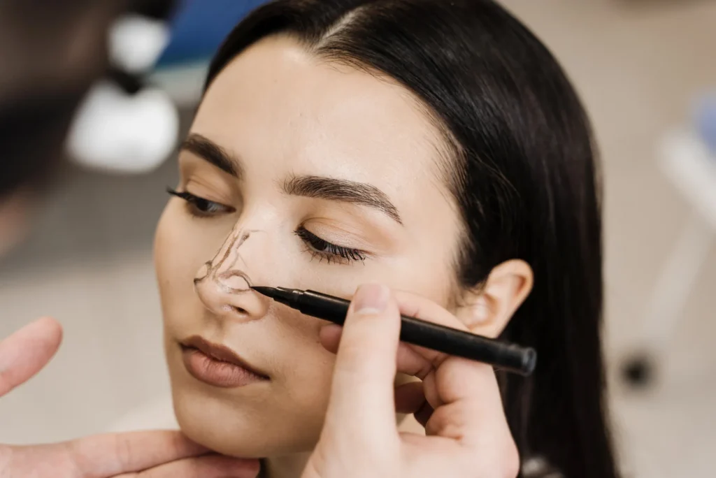 Understanding the Rhinoplasty Turkey Price